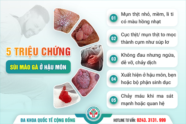 Sùi mào gà ở hậu môn và mối nguy hiểm chưa ai nói cho bạn biết