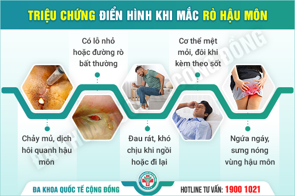Cắt rò hậu môn: Đâu mới là phương pháp tối ưu nhất?