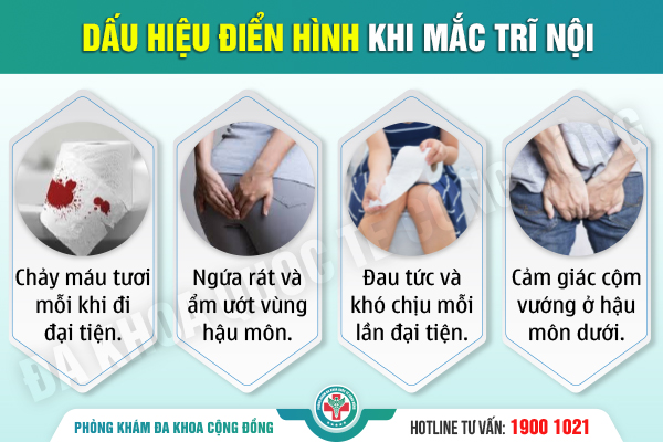 Từ A – Z về bệnh trĩ nội: Đừng chủ quan với căn bệnh “nhạy cảm” tại hậu môn