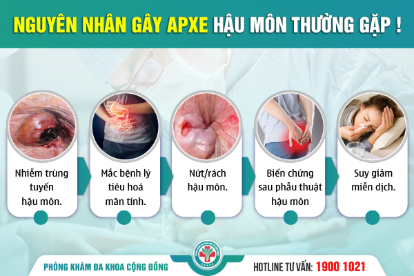 Nguyên nhân gây áp xe hậu môn – tổng hợp 7 thủ phạm giấu mặt