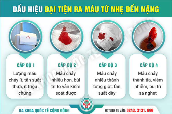 [Cảnh Báo] Đi ngoài ra máu đỏ tươi – Dấu hiệu nhẹ hay bệnh lý nguy hiểm