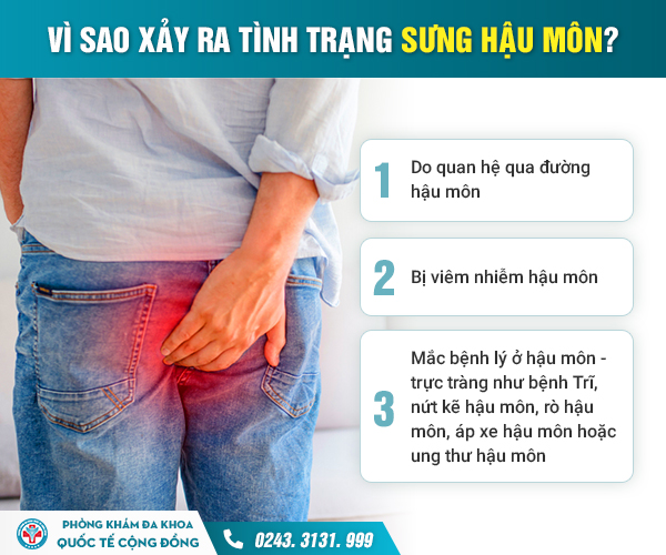 Hậu môn bị sưng – Đừng xem thường, có thể là dấu hiệu của bệnh lý nguy hiểm!