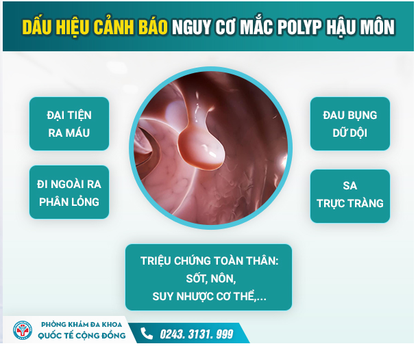 Giải đáp từ A-Z về Polyp hậu môn: Cẩn thận nhầm lẫn với bệnh trĩ