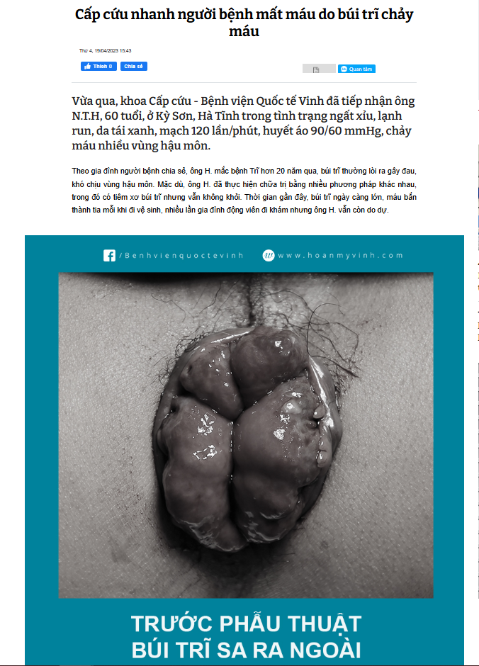 Tìm hiểu chi phí khám trĩ – Đừng để lo lắng cản bước bạn