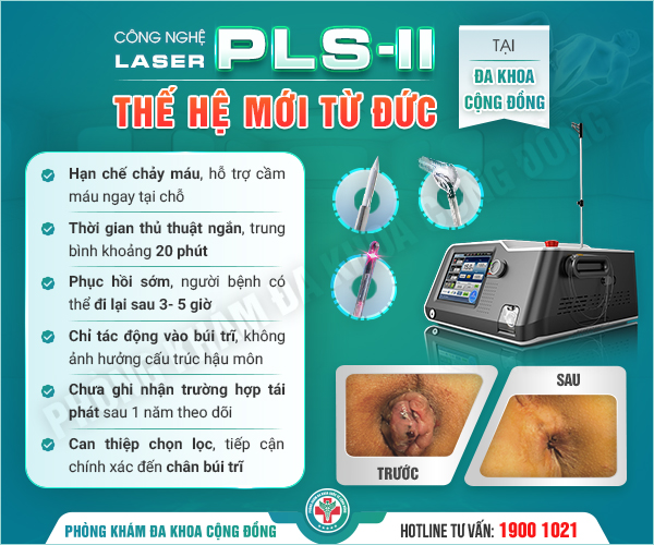 Búi trĩ lòi ra ngoài – Triệu chứng cảnh báo trĩ đã đến giai đoạn nguy hiểm